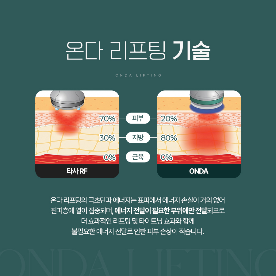 온다 극초단파와 고주파의 에너지 전달 특성을 비교한 이미지