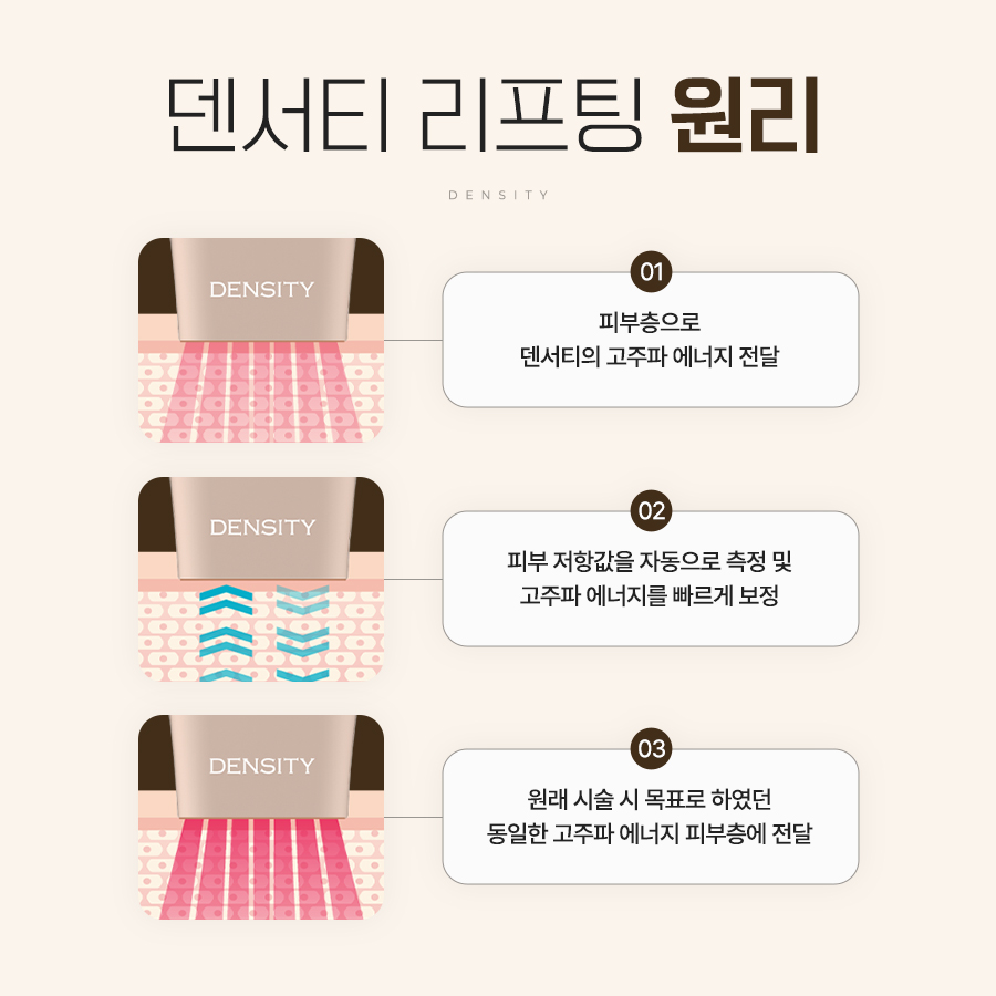 덴서티 피부 임피던스 측정과 고주파 에너지 보정 원리
